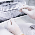 Stomatologia zachowawcza Gliwice - Stomatolog Gliwice