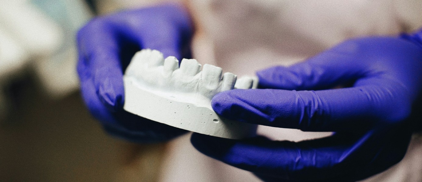 Dentysta w rękawiczkach trzymający odlew zębów